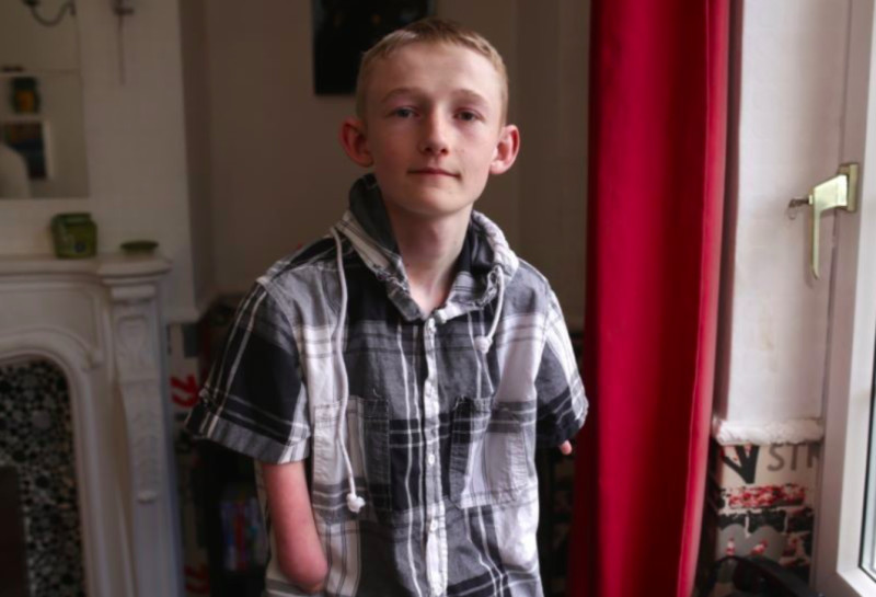 Other image for Teen one step closer to ‘new arms’ dream